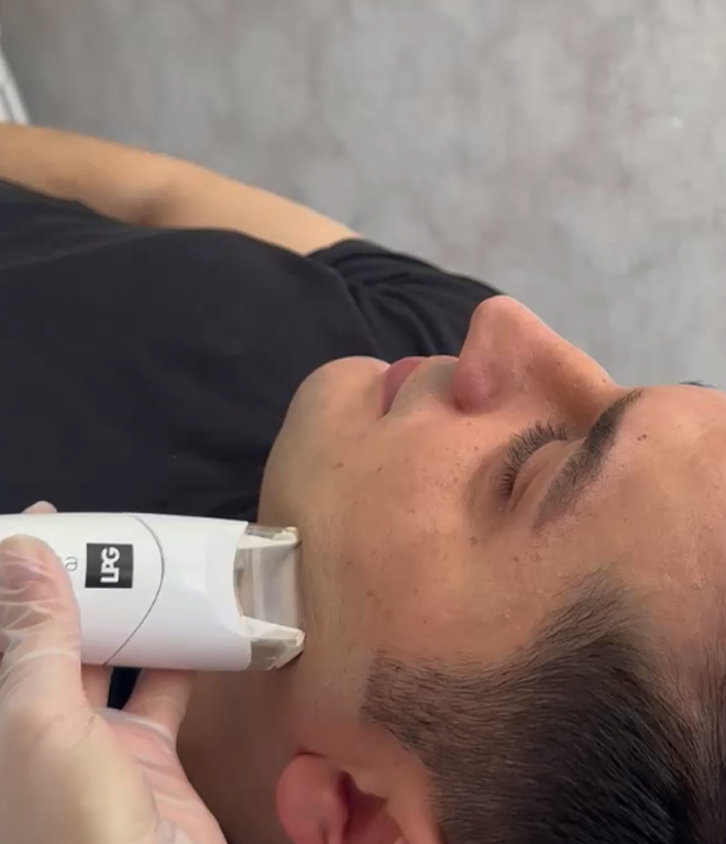 Erkek LPG - Mobilift 